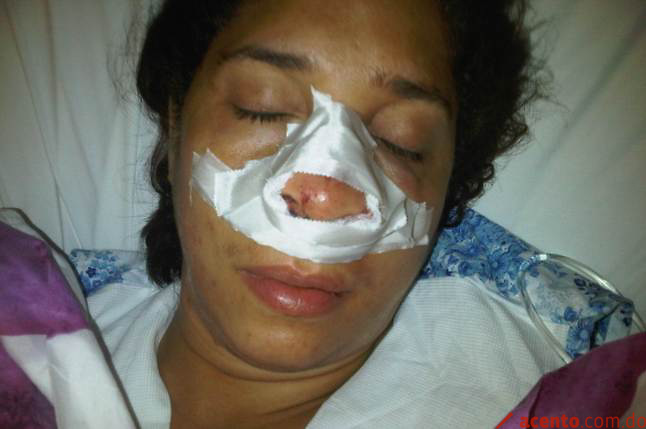 Hombres agreden guagua a pedradas y por poco matan a una mujer