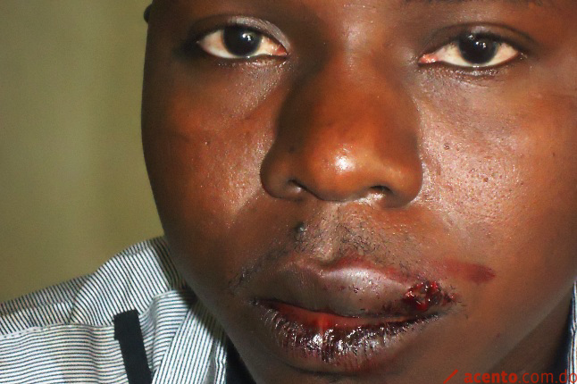 Militar CESFRONT propina paliza a joven haitiano porque se negó a darle dinero