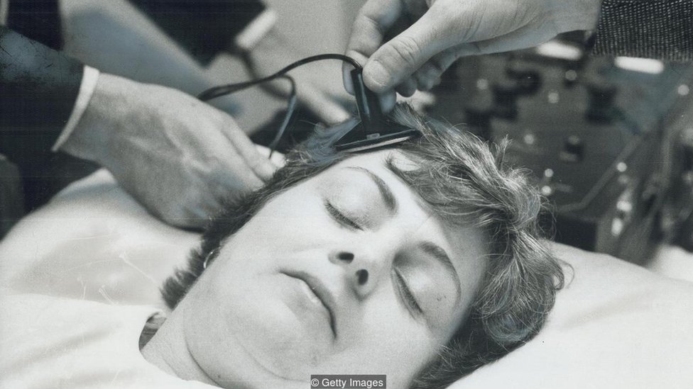 Por qué existe el estigma contra la terapia de electroshock pese a ser eficaz contra la depresión profunda (y 10 veces menos peligrosa que un parto)