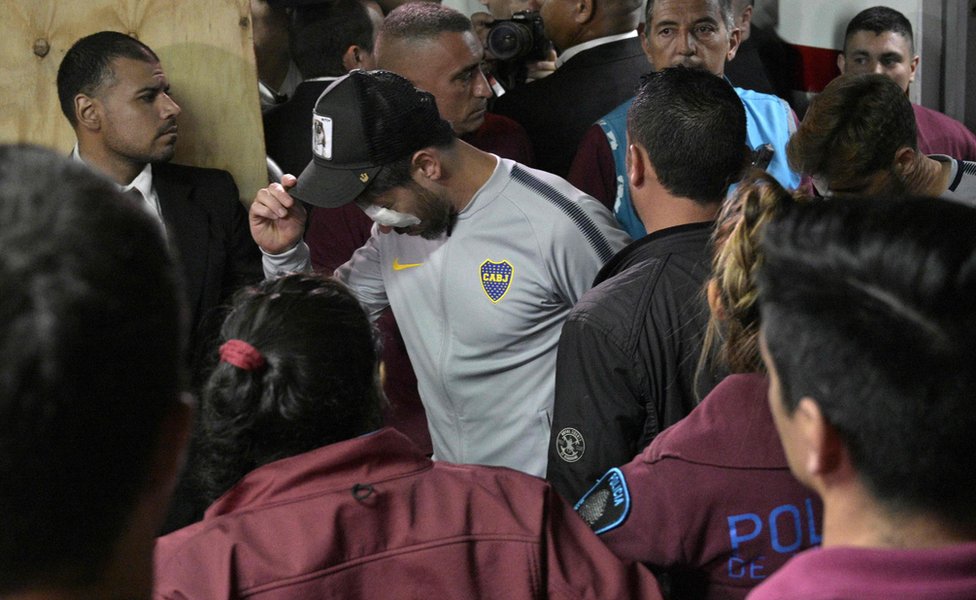 Final Copa Libertadores River vs. Boca: las primeras imágenes de los jugadores de Boca Juniors tras el ataque de seguidores de River Plate