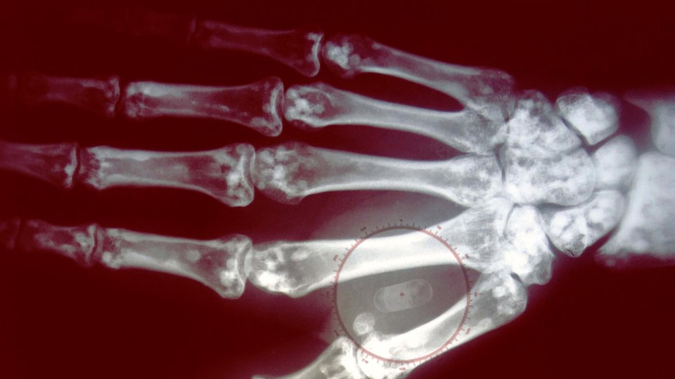Cómo funcionan los microchips que se implantan bajo la piel y permiten pagar sin efectivo ni tarjeta