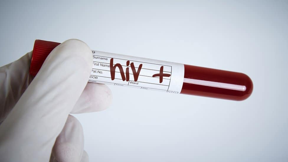 VIH/sida: cuáles son los países de América Latina con mayor aumento de nuevos contagios