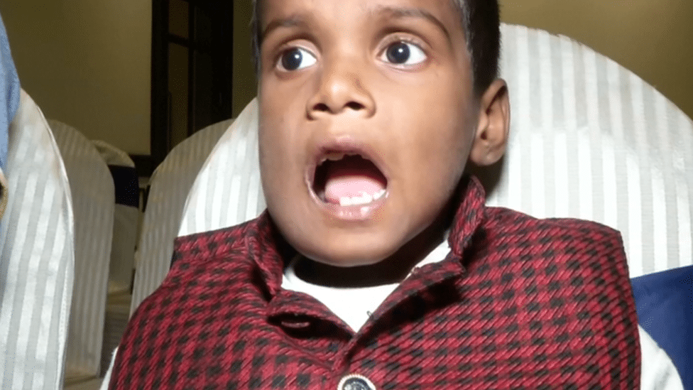 El extraño caso de un niño al que le extrajeron 526 dientes