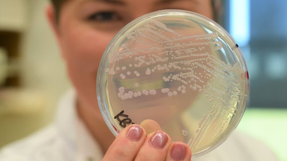 Las bacterias que se deshacen de su pared celular para evadir a los antibióticos