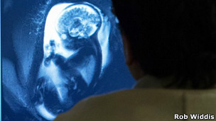 Identifican por primera vez conectividad cerebral del feto en el útero