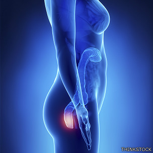 ¿Realmente sentarse en superficies frías o calientes da hemorroides?