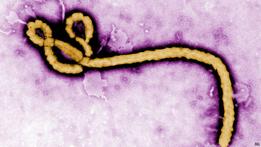 ¿Por qué se suspendió la prueba de la vacuna contra el ébola?