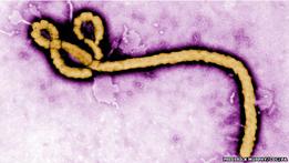 Prueban en Guinea test para diagnosticar ébola en 15 minutos