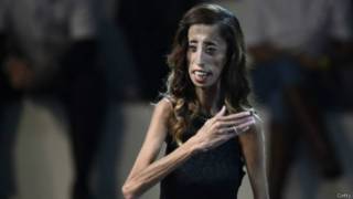 4 tragedias con final feliz que nos conmovieron en 2015