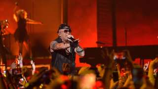En qué consiste el Síndrome de Patau, la rara enfermedad de la hija del reggaetonero Wisin