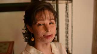 Condenan a 21 años de cárcel al joven que agredió a Natalia Ponce de León, estandarte de la lucha contra los ataques con ácido en Colombia