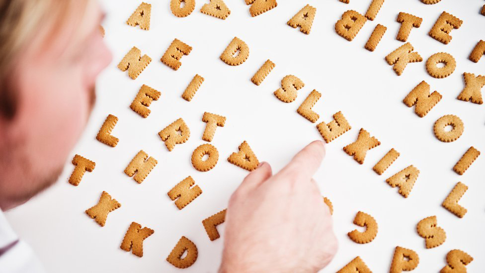 La sorprendente teoría sobre el origen de la dislexia y cómo esta puede curarse