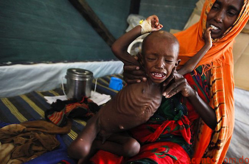 La crisis en alimentaria en el Cuerno de África