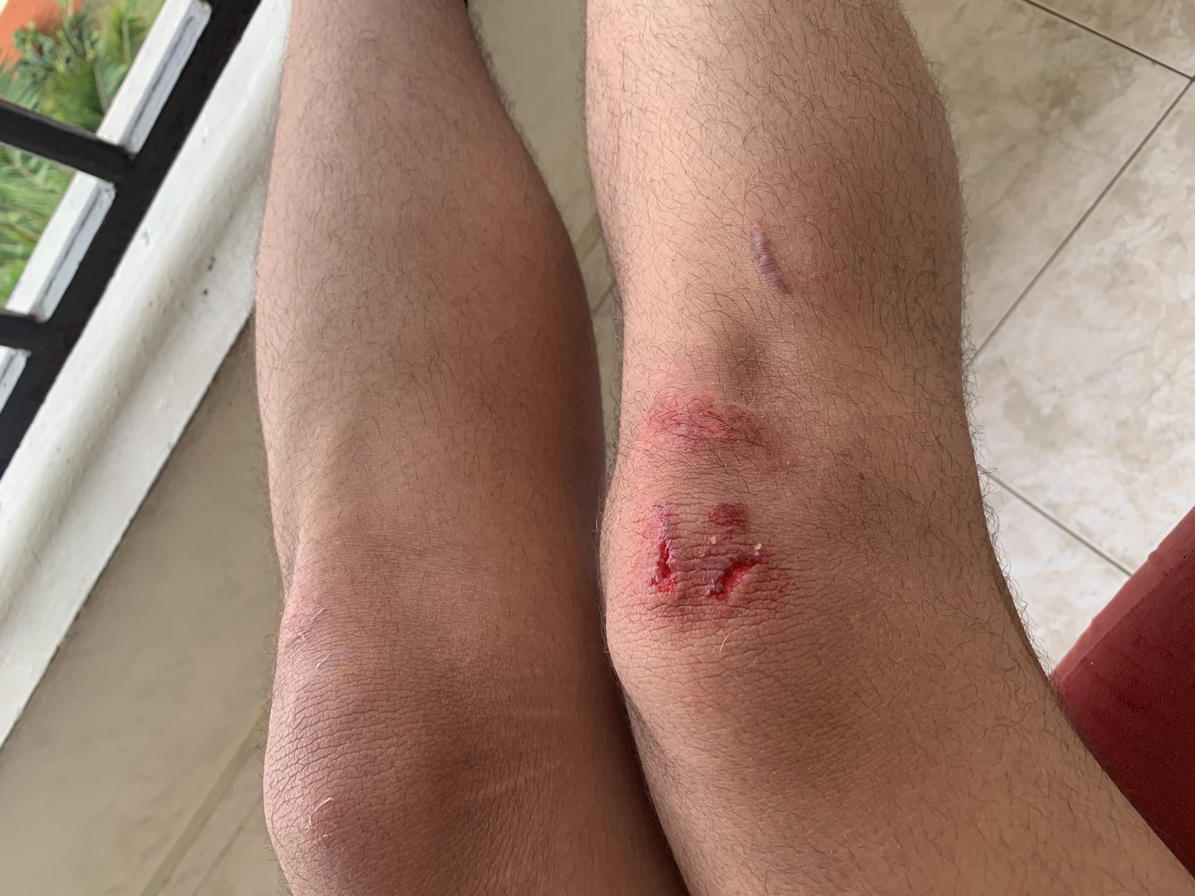 Periodista denuncia intento de atraco a nieto cuando iba para el trabajo