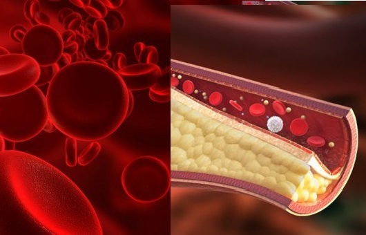 Científicos redimen a las grasas saturadas de acusaciones por hipercolesterolemia