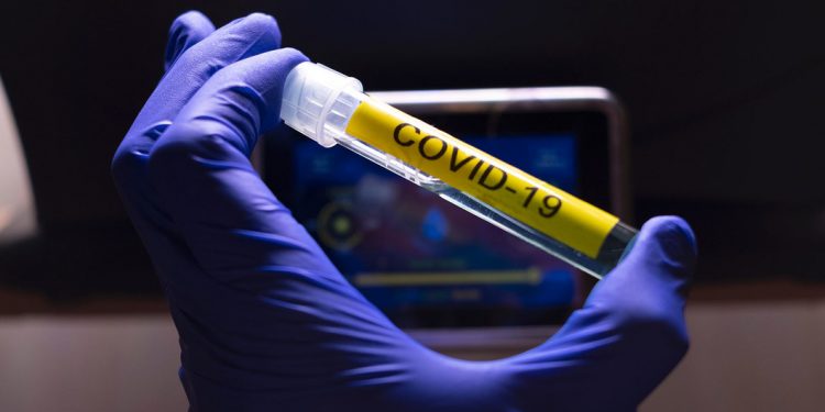 Rusia ya tiene vacuna contra la COVID-19