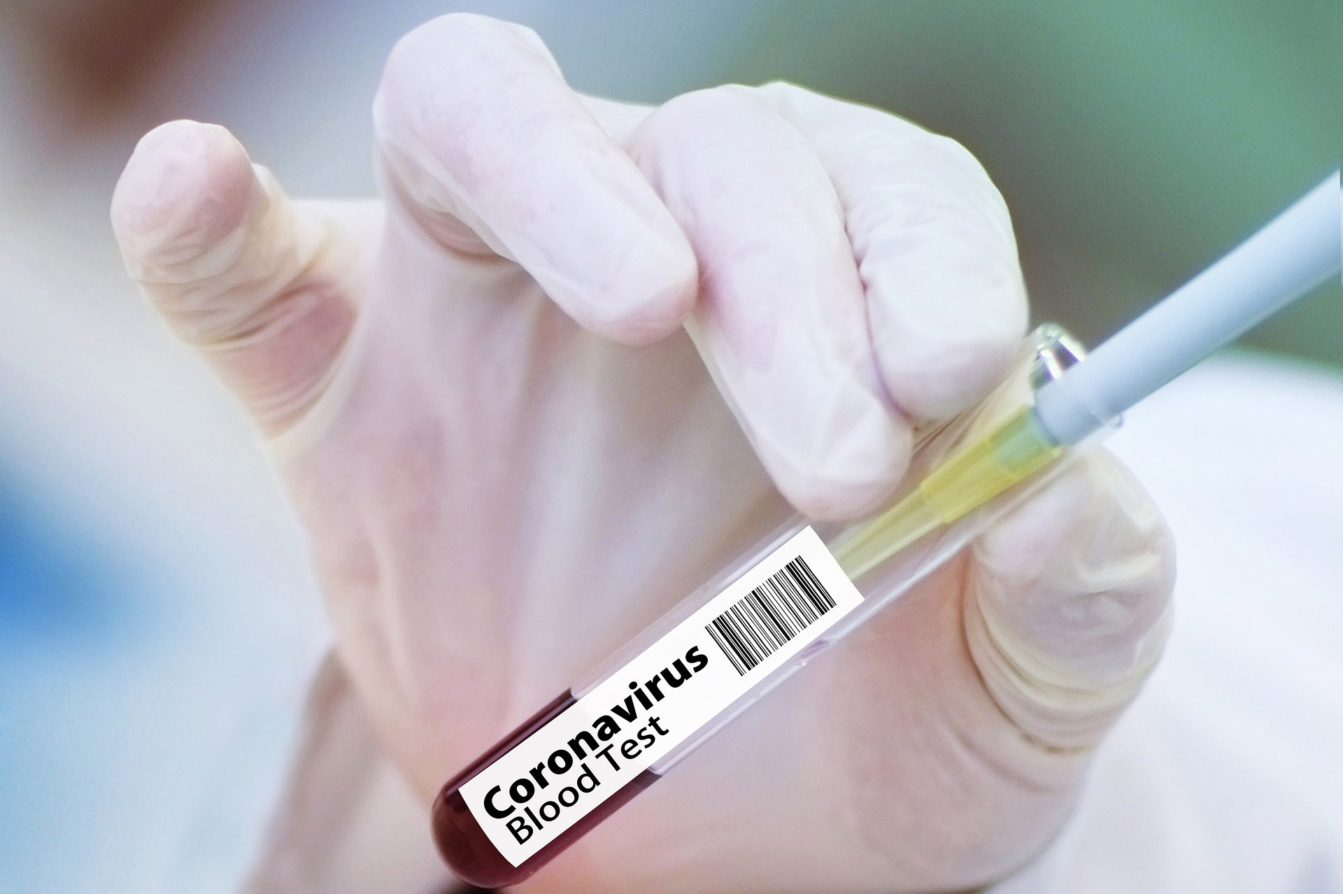 Coronavirus: 165 contagios y 1 defunción en las últimas 24 horas