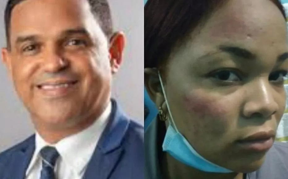 Suprema conoce caso contra diputado Sadoki Duarte por agresión a mujer policía
