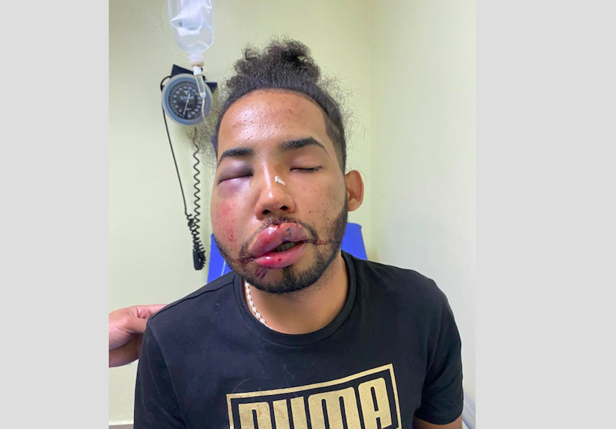 Denuncian policías golpean brutalmente a joven en La Vega