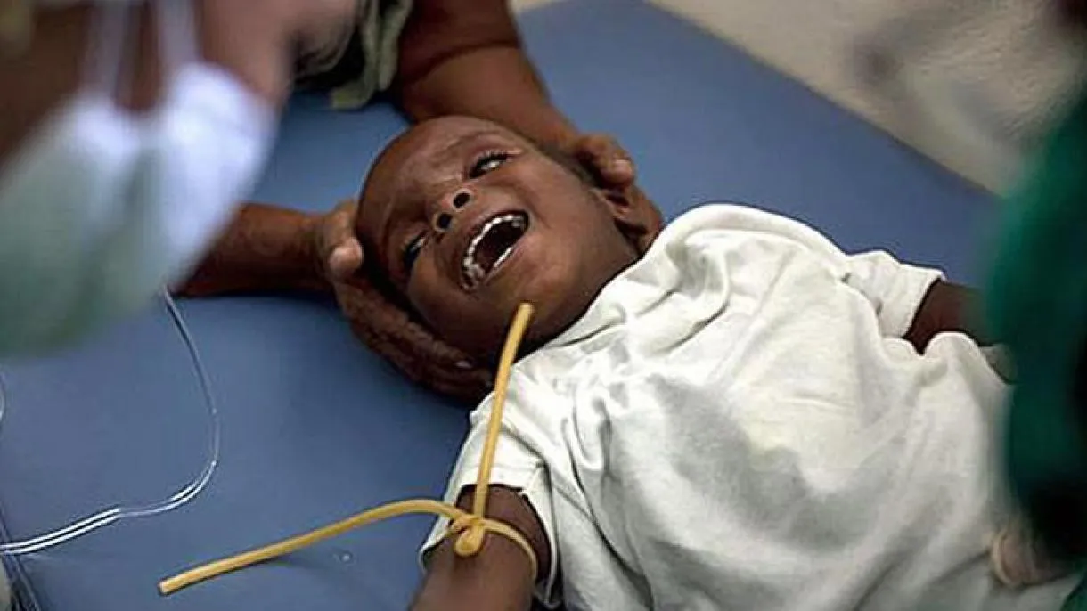 Número de menores con desnutrición en Haití puede duplicarse este año
