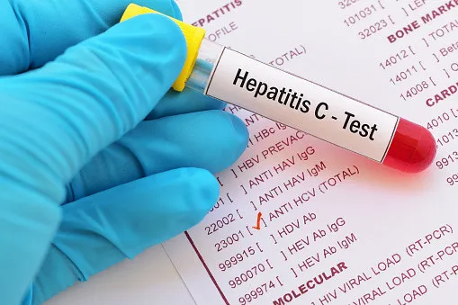 Campaña contra la hepatitis C llama a la población a hacerse la prueba
