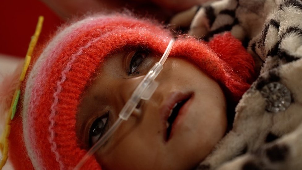 Pasé toda la noche con miedo a que en cualquier momento dejara de respirar: el silencioso drama de la hambruna que golpea a miles de niños en Afganistán