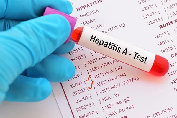 Las 5 hepatitis virales, conoce cuáles son y sus síntomas