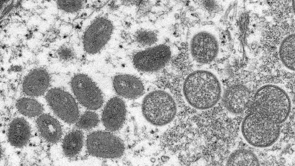 Viruela del mono: cuál es el perfil de los infectados y cómo puede cambiar a medida que avanza la enfermedad