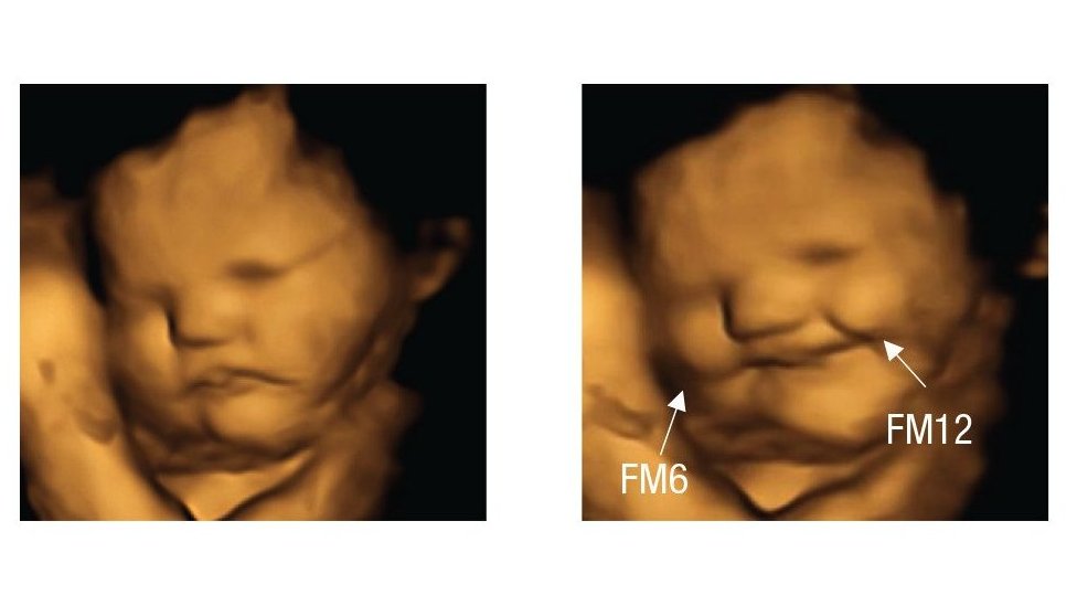 El estudio que mostró que los bebés en el vientre sonríen cuando sus mamás comen zanahorias y fruncen el ceño cuando comen col rizada