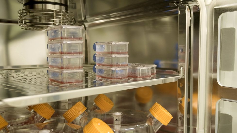 Los pacientes que recibieron sangre artificial en una prueba clínica sin precedentes