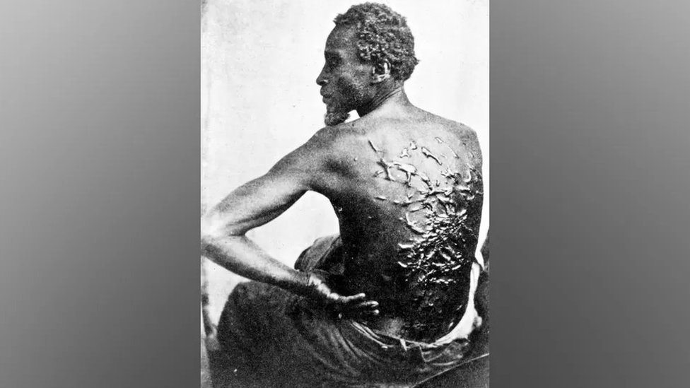 La verdadera historia de Peter azotado, el esclavo cuya desgarradora fotografía cambió la percepción de la esclavitud en Estados Unidos