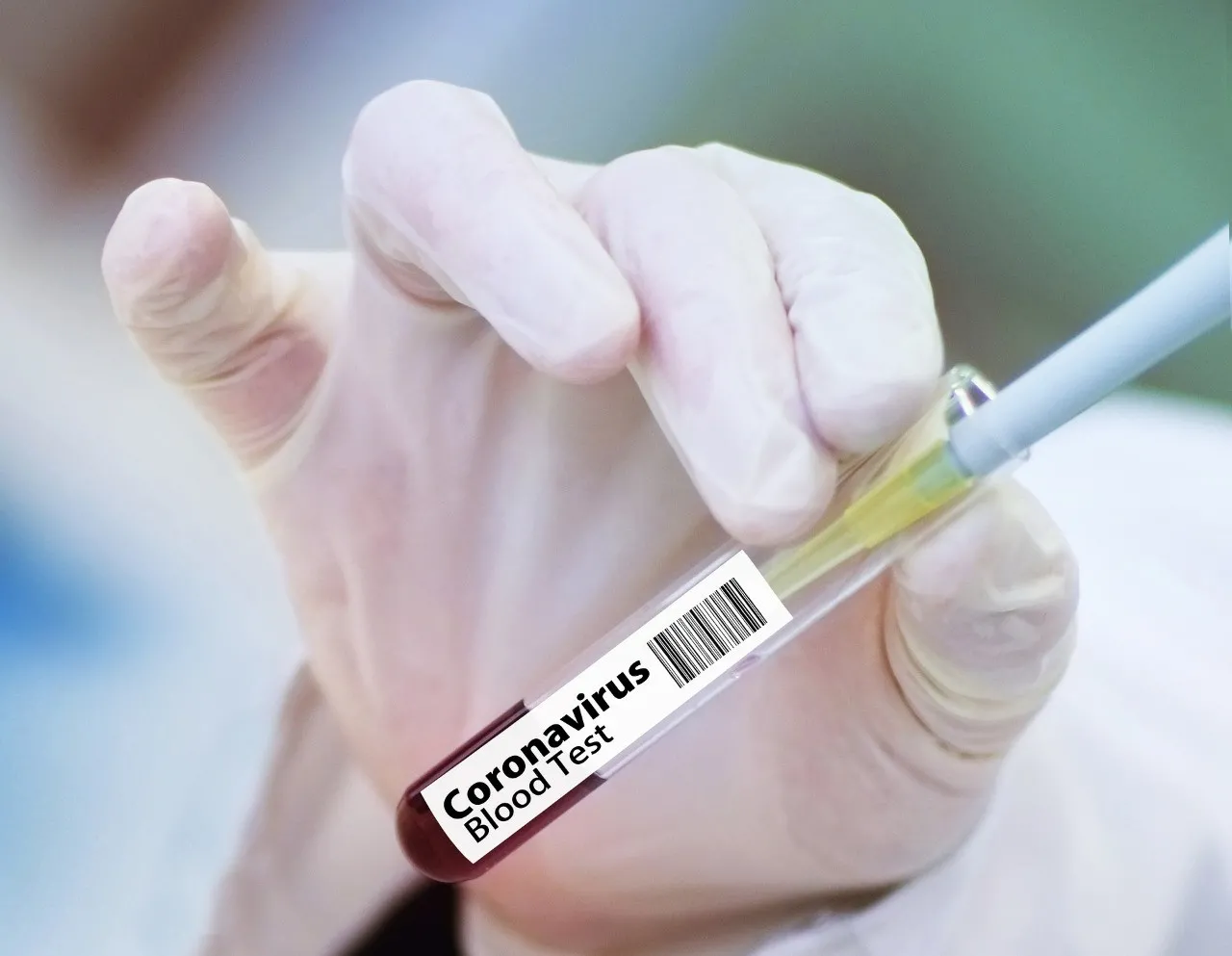 Reportan 1,384 nuevos contagios de COVID en una semana