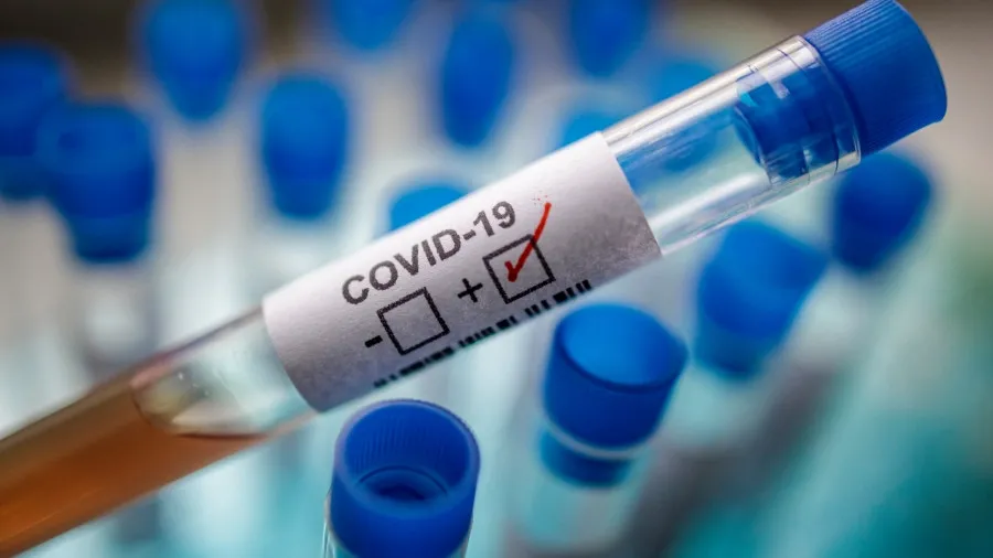 Casos activos de COVID-19 suman 267 tras notificarse 21 nuevos contagios