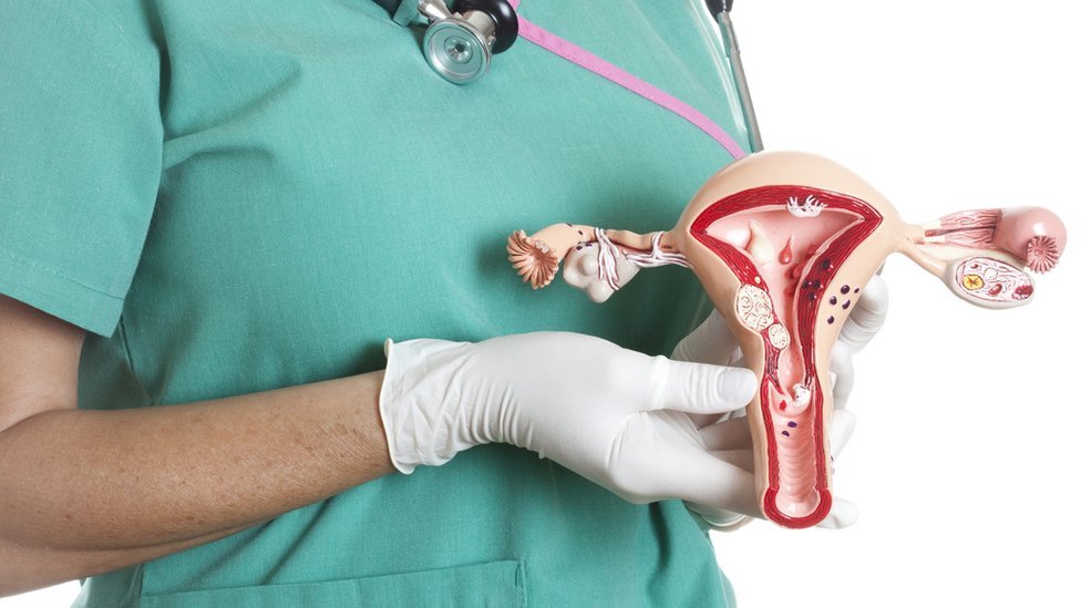 “Me dijeron que mi cáncer terminal era un fuerte sangrado menstrual”