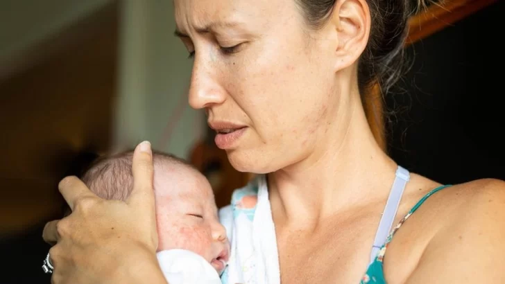 Qué es el “baby blues” que afecta al 85% de las mujeres y en qué se diferencia de la depresión posparto