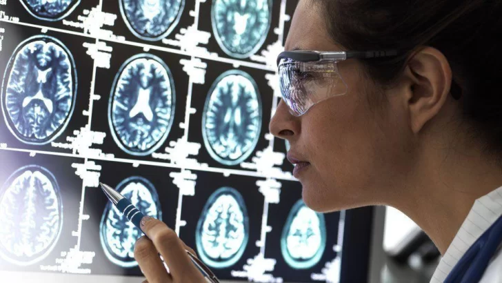 2 buenas noticias sobre el tratamiento de la enfermedad de Alzheimer (y una mala de otras formas de demencia)