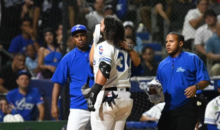 Alfaro de Tigres fuera una semana tras pelotazo en el rostro ante las Águilas