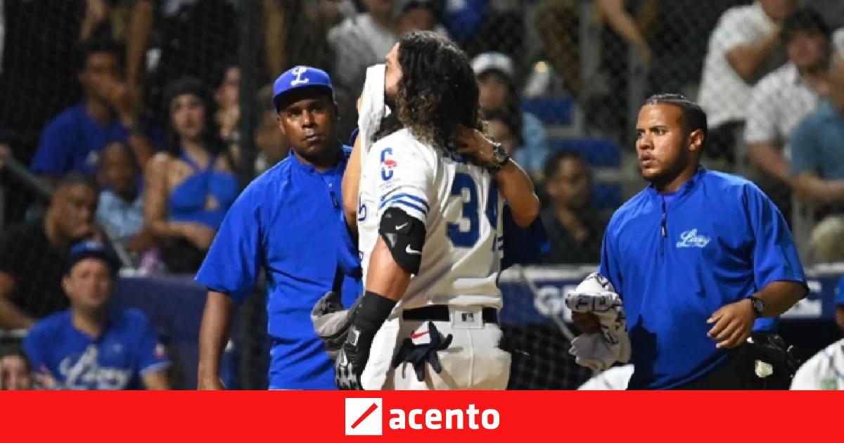 Alfaro de Tigres fuera una semana tras pelotazo en el rostro ante las ...