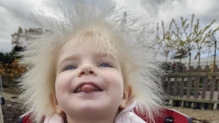 'El pelo de mi hija es hermoso': qué es el síndrome del cabello impeinable causado por una mutación genética