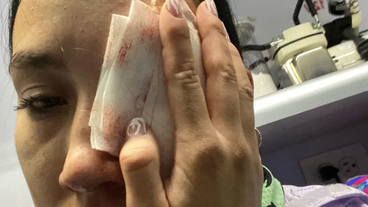 'Si las balas de goma pueden destrozar una manzana, imagínense lo que hicieron con mi ojo'