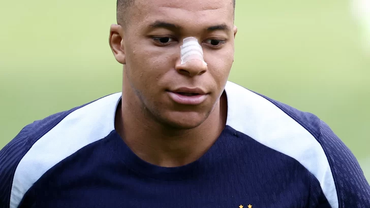 Eurocopa pendiente del regreso del fracturado Mbappé