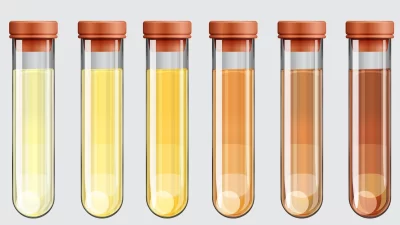 Qué significa el color de tu orina y cuándo debes preocuparte