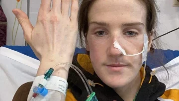 Gastroparesia: 'Tenía el estómago paralizado y creyeron que sufría de anorexia' Gastroparesia: 'Tenía el estómago paralizado y creyeron que sufría de anorexia'