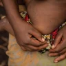 OMS mantiene la emergencia internacional por la mpox ante el elevado número de casos