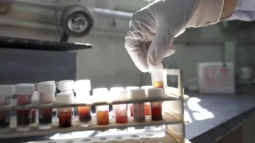 El contagio de VIH a seis pacientes sacude al sistema de trasplantes de Brasil