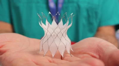 Implantados primeros 'stent' con forma de 