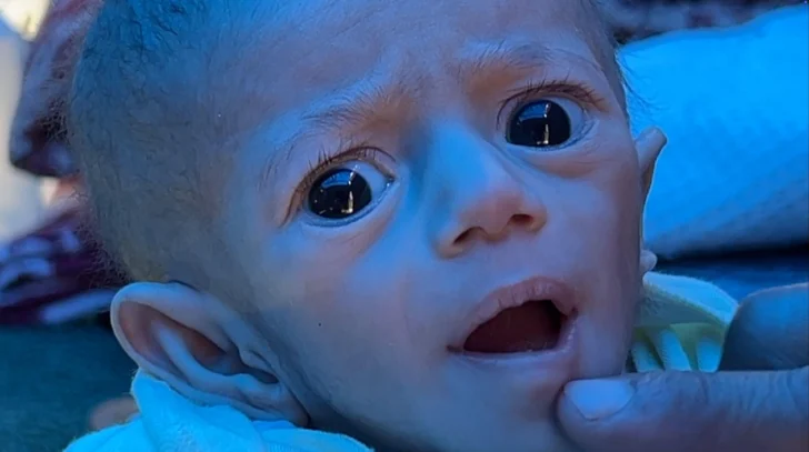 'La situación es desesperada': la BBC regresa al sitio en Gaza donde una bebé casi muere de hambre debido al bloqueo israelí