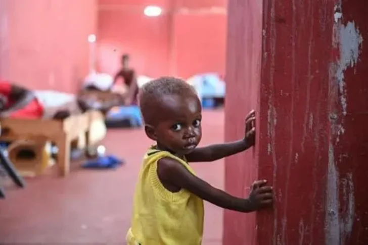  David, de 19 meses, forma parte de los niños desnutridos que son atendidos en el centro hospitalario de Fontaine, ubicado en un barrio pobre de Puerto Príncipe, el 4 de agosto de 2023 AFP