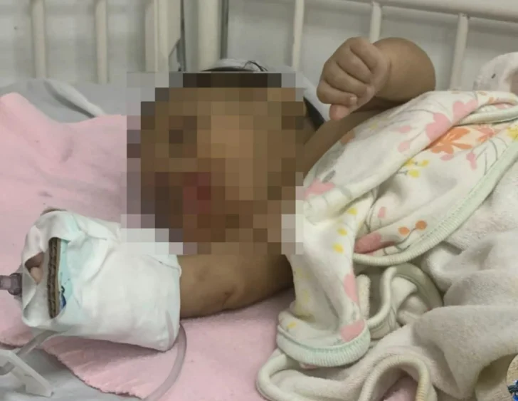 Bebé de un mes en estado crítico tras presunta golpiza de su madre en Miches