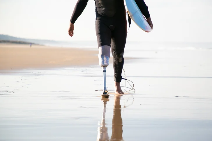 unrecognizable-surfer-with-leg-prosthesis-walking-near-sea-728x485 turismo inclusivo